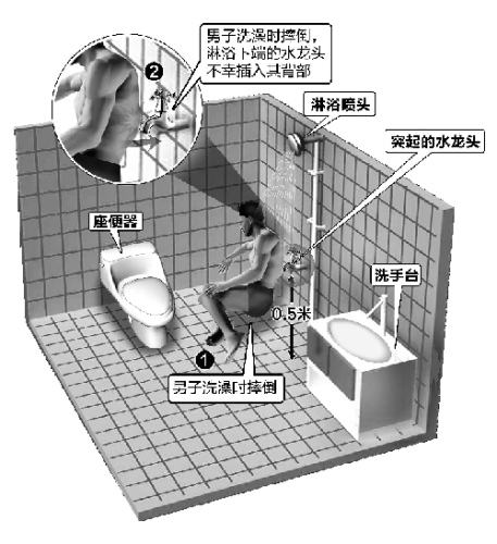 男子洗澡时滑倒致水龙头插进背部(图)