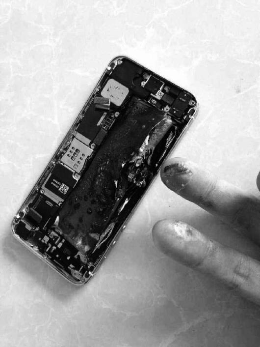 男子手机突然爆炸手指烧伤 苹果售后：非质量问题