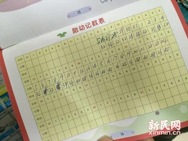 上海新生儿遭家人“毒杀” 医院无兔唇检测设备