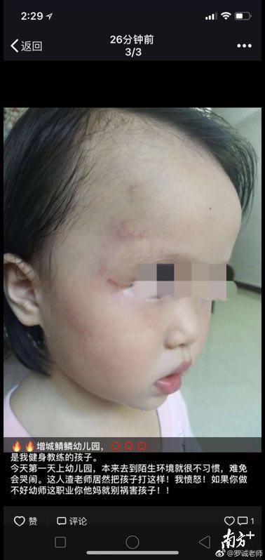 广州一幼儿园被曝虐童 涉事老师已被警方带走调查