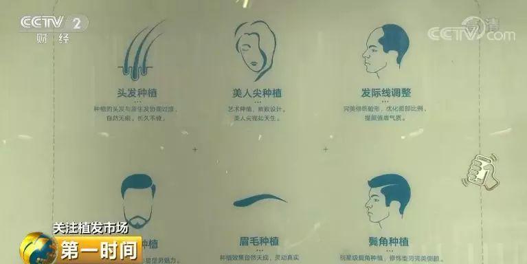 中国脱发人群超2.5亿 脱发人群年龄下沉