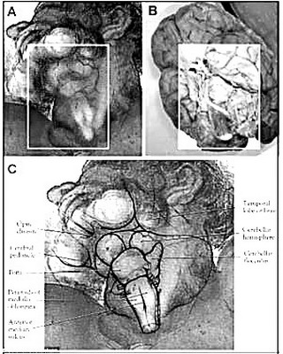 米开朗基罗壁画:上帝颈部是大脑解剖图?(图)