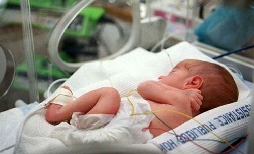 英国“拇指宝宝”庆1岁生日 出生体重不到500克 