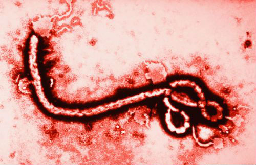 美卫生官员：埃博拉病毒或将成下一个“艾滋病” 