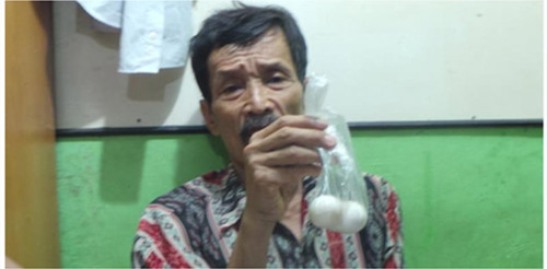 六旬印度尼西亚老翁因腹痛“产下”生鸡蛋(图)