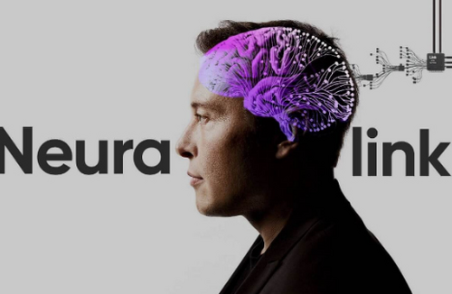 美国“神经连接”公司人脑植入物试验已获监管机构批准