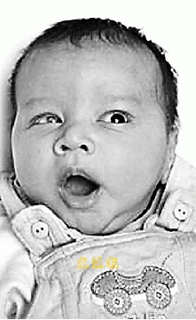 英国7月男婴将接受人工眼角膜移植手术(图)