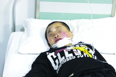 江苏金坛一小学校车接学生出意外 6名孩子受伤