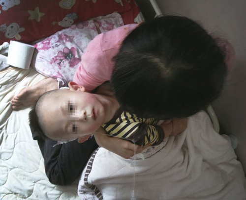两岁儿童做疝气手术脑萎缩医院承认“麻醉意外”