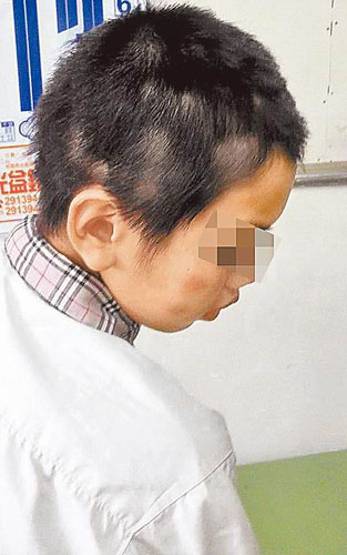 台灣一男童遭父親與繼母聯手淩虐全身瘀傷（圖）