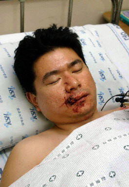 图:国航空难幸存者机长吴新禄在医院休养