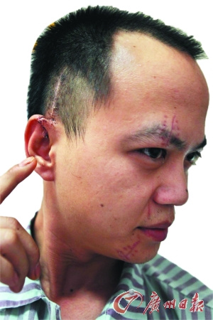 男子赌博输钱泄私愤刀砍治安员致其重伤(图)