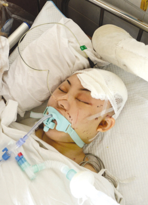 女歌手身负百余伤深夜坠楼脑死亡 涉案男友失踪