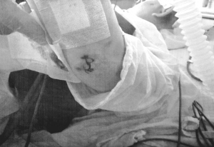 �������ϳ����ϰٴ��˺�