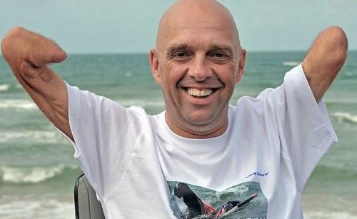 ʧȥ��֫�ķ����м��˷����գ�������������Ӿ�ķ�ʽ������ޡ����ӡ���������Ŀǰ�Ѿ������3�κ�ɡ�