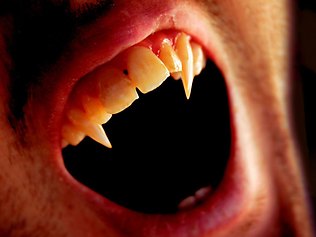 ��Ѫ�����ߡ�����ŵά��������ά���������Ĺ���(����ͼ)