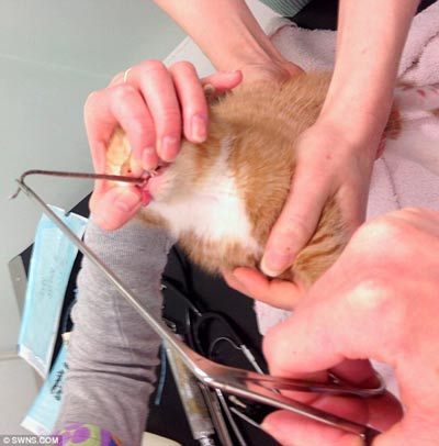 ��ҽ������β�ʹ�����˹������γ�