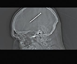 ����X��Ƭ�п�������������֥�Ӹ����Ӱ�ͼ��������ĳ�����