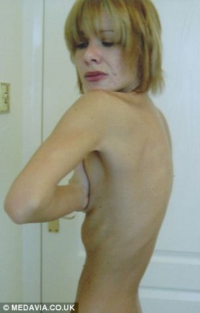 ���ڷ���ʳ���ն�������ʳ֢����26��ʱ����������ֻ�в���29�����������Ժ���ơ�