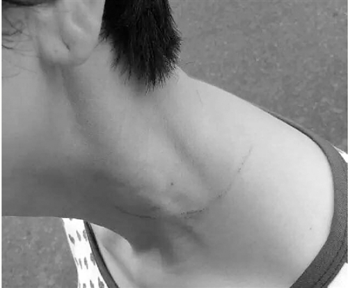 лŮʿ�����ϱ���������ʱ���µ�Ѫ�ۡ�