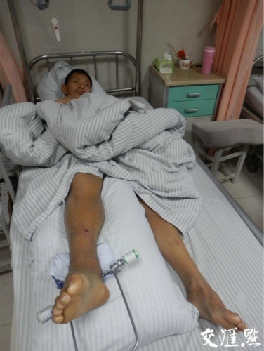 居民称被拆违城管打断腿 执法视频仅有6秒(组图)