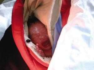 ������������ŮӤ���ƿ�ӳ�ҽԺ