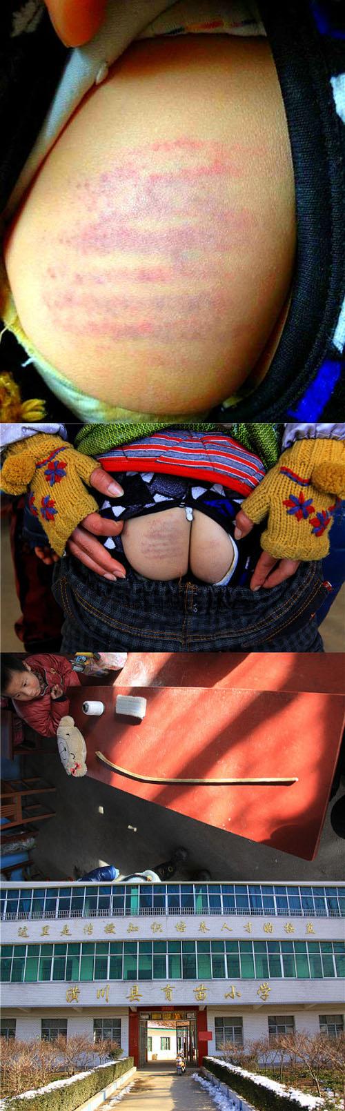 4岁男生黄兴(化名)因为忘带作业本,被该校两名教师轮流用教鞭抽打屁股