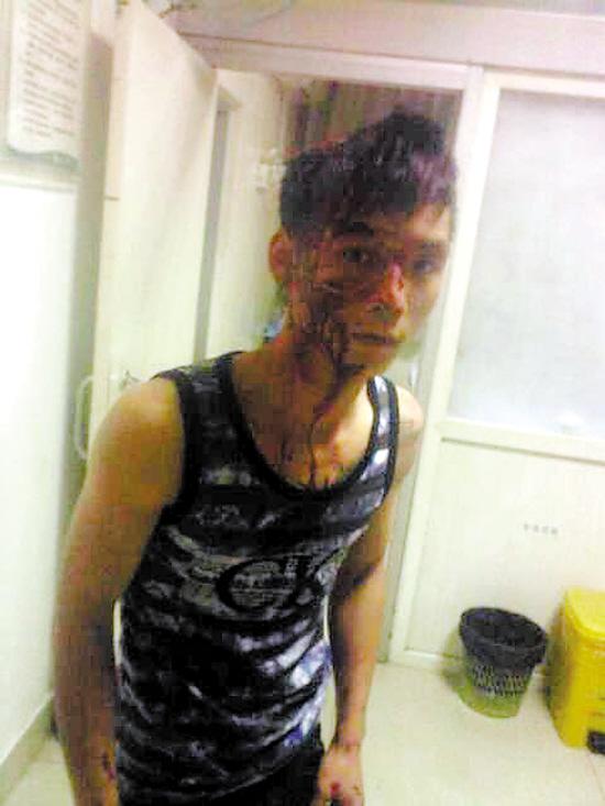 "围观"者与执法者口角 被一路暴打头破血流