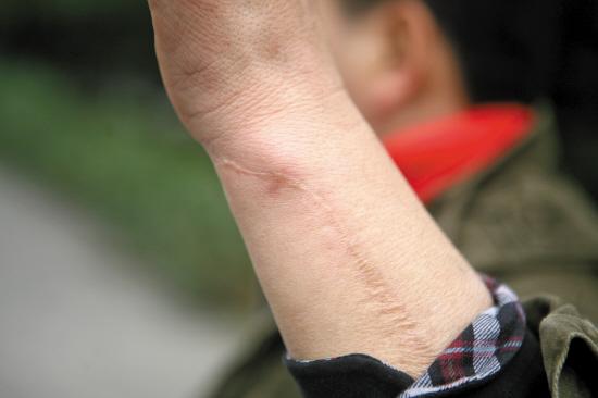 男子路见不平揍小偷 被要求赔偿医药费