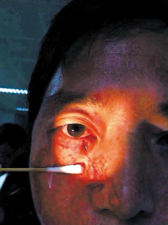 男子欲插队打伤护士 事后道歉请求给改过机会(图)