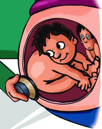 男婴娘胎里被双胞胎哥哥挤扁 被发现时厚1厘米(图)