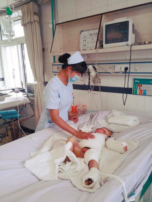 前胸,呼吸道和口腔被烫伤