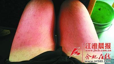 ���ӱ�ɹ�ɡ��ع��� ����6������ɹ�˷�չͼ(ͼ)