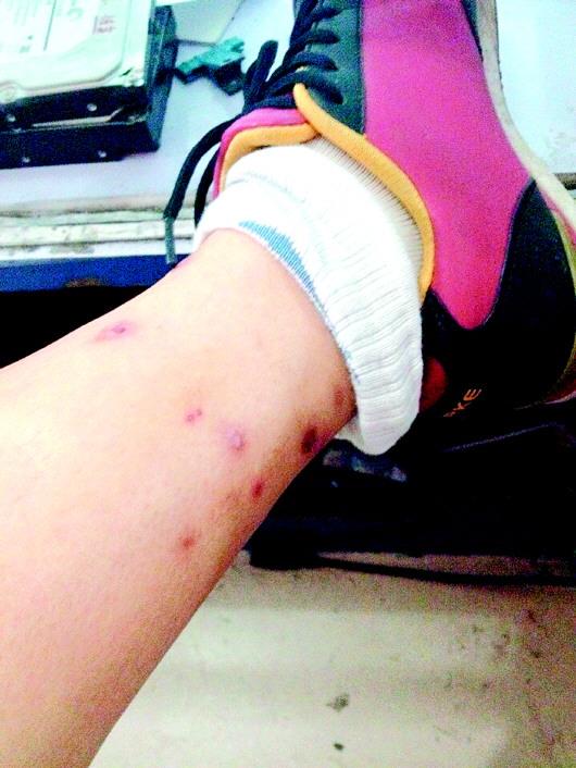 居民楼内上演"疯狂的跳蚤" 流浪猫环境差是主因