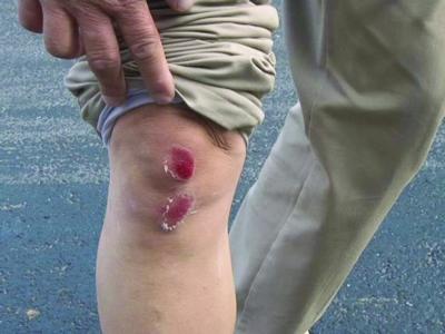 扫地车路上漏油数百米 众多市民滑倒摔伤(图)