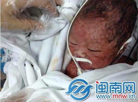 弃婴被及时救起(微博图)