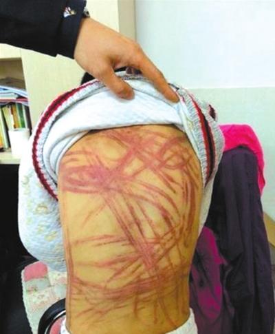 ʩĳĳ����ñ������ˡ������ͼ