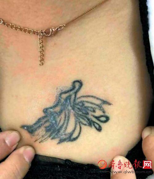 泰国纹身女子皮肤溃烂图片