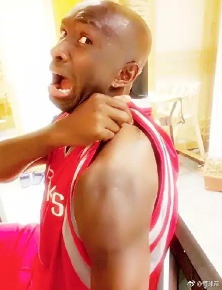 华夏外援胳膊晒黑照热传图解人为何会被晒黑