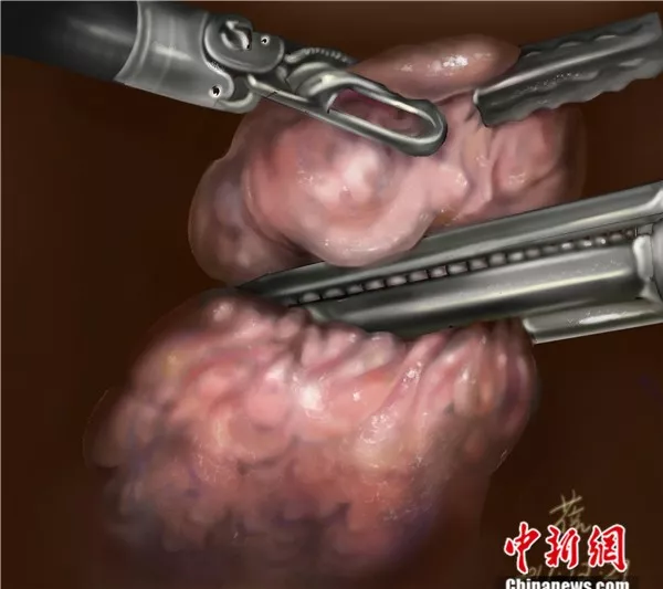 医学界的神秘行当曝光高薪难求竟是因为