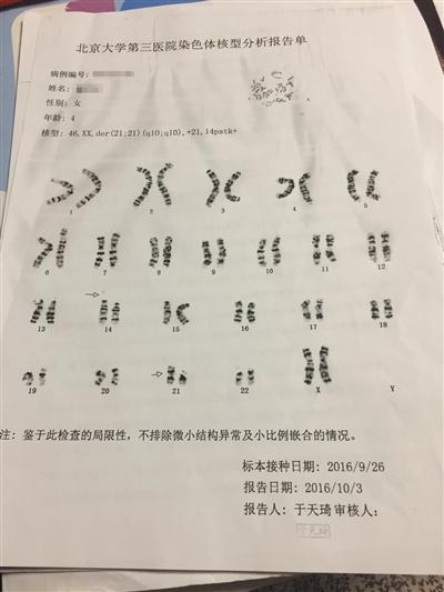 染色体报告单图片