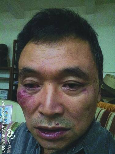 ��Ź����ԭ���������������Ļ�����һ����һ��