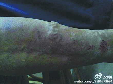 ��Ź����ԭ���������������Ļ�����һ����һ����2��