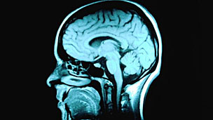 ��ʿ����ģ����������о��ƻ���ֵ16����Ԫ