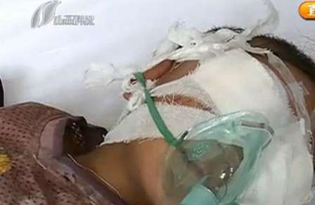 ɽ��6��˫�۱�����ͯ��������Σ�ձ�������֦���ۣ�ͼ����2��