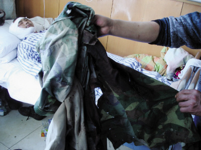 男子进山采药遭遇大黑熊后脑和大腿被啃露骨头(图)