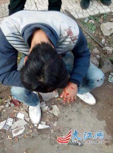 中学生遭多名成年男子围殴男子劝架遭报复被砍(图)