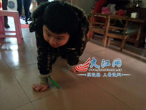 九龄童基因突变只能终日爬行不畏艰难坚持上学(图)