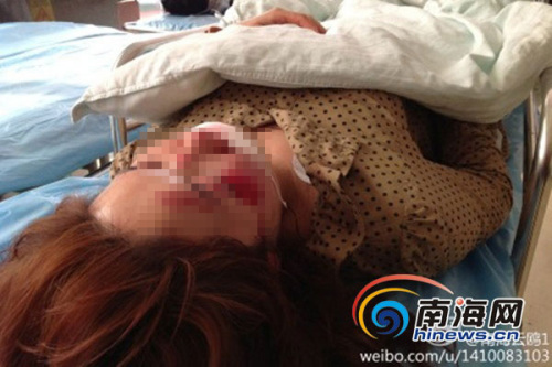 海口一幼儿园女教师被撞昏迷肇事黑色轿车逃逸