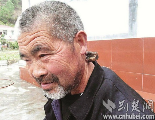 ���˲����ϳ���һֻ�����ǡ�����35��ÿ���2�Σ�ͼ��